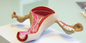 Uterusmodel